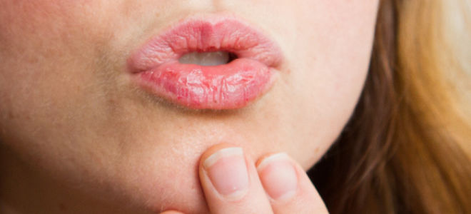 Как можно помочь обветренным губам?